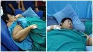 Muhammad-Fajri-seorang-pria-yang-mengalami-obesitas-hingga-300-kilogram-sfd