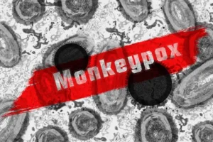 monkey-pox-7217582_960_720