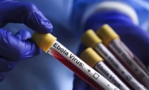 ebola virus - anadolu